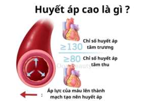 hoa thien dieu 624 x 312 px 470 x 312 px 21