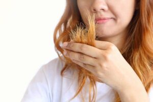 Tóc bị tổn thương