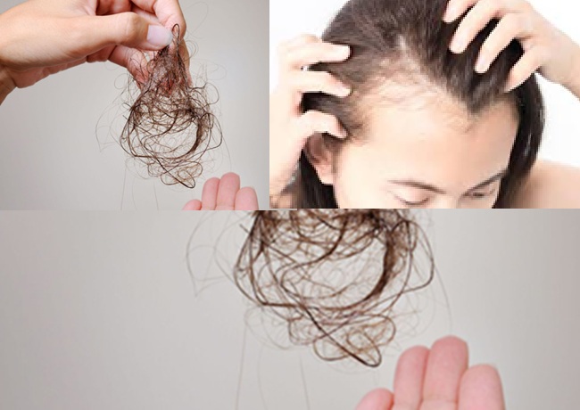 Xịt tóc cho người rụng nhiều