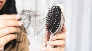 Tóc dễ gãy