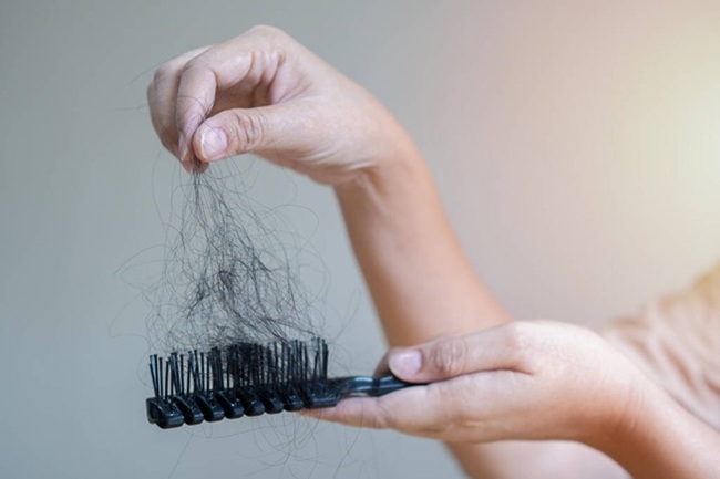 Giải pháp cứu tóc rụng