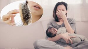 Tóc rụng sau sinh