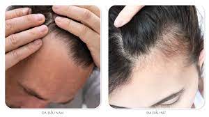 Dầu gội tốt cho tóc và da đầu nam giới 