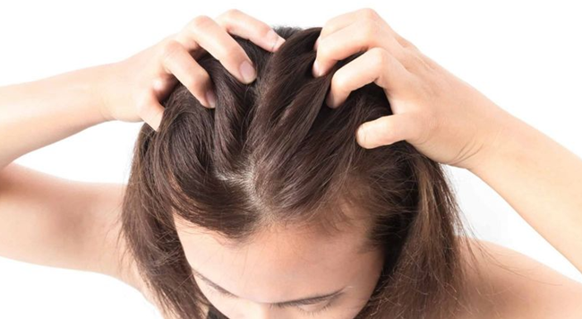 OoaBeauty trị gàu phù hợp với tóc